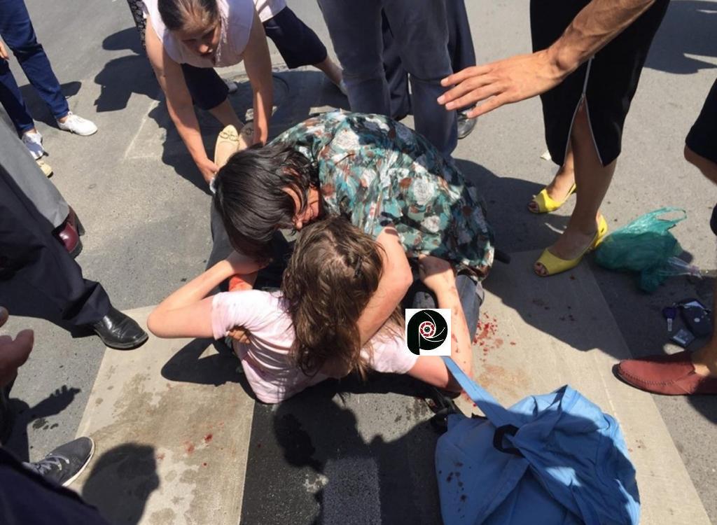 Aksident ne Elbasan