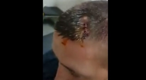 Dhunohet vëzhguesi i LSI, administratori i PS-së levë kokës (VIDEO)