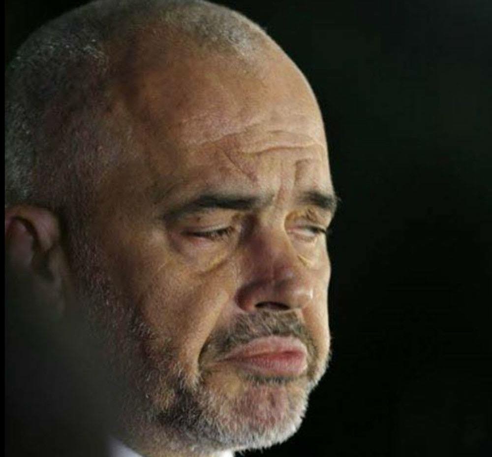 Edi Rama është sëmurë me Sindromen PTSS
