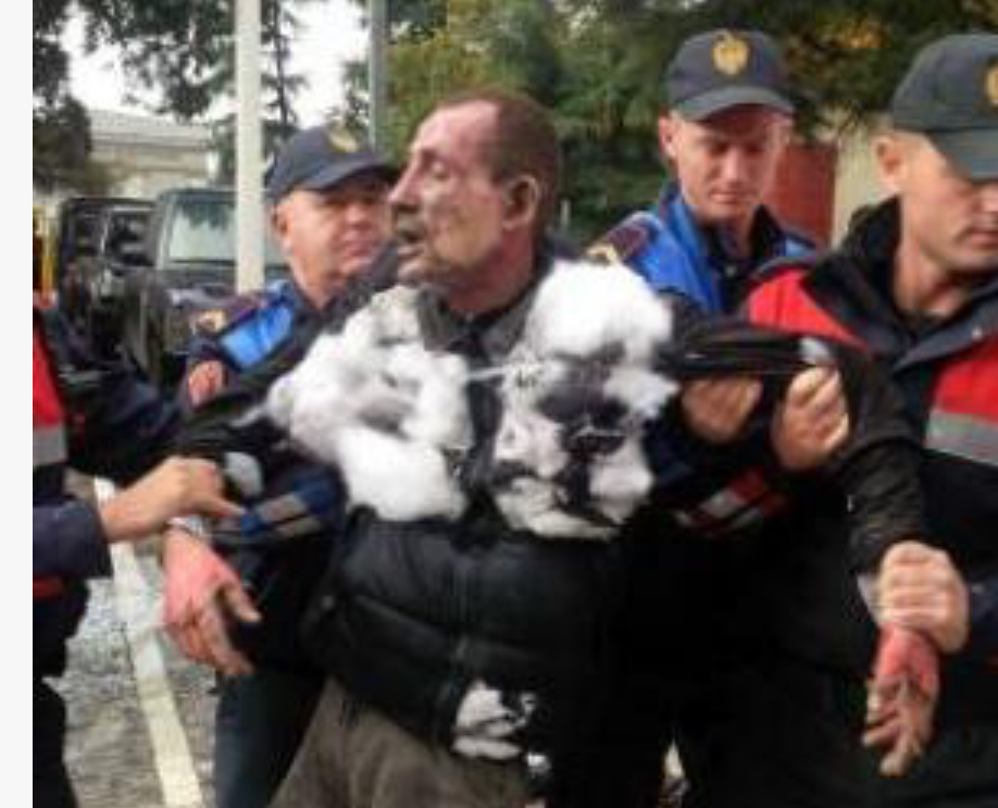 Tentoi të vetëdigjej para parlamentit, policia ndalon 35-vjeçarin nga Lezha