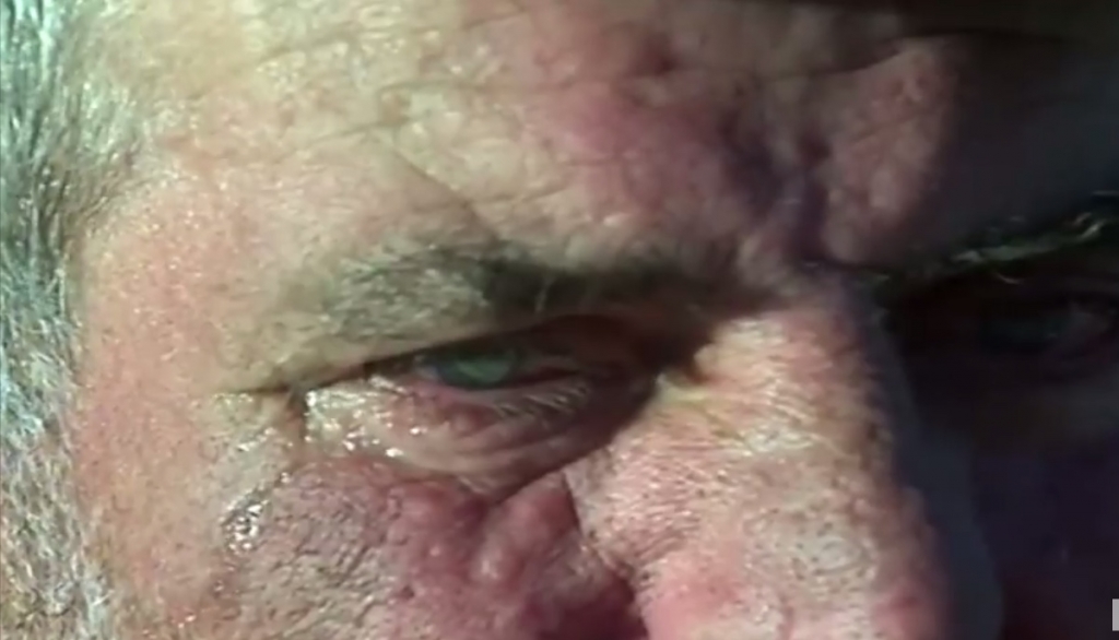 Reportazh/Sepse mjerimi është ulur këmbëkryq në Shqipëri