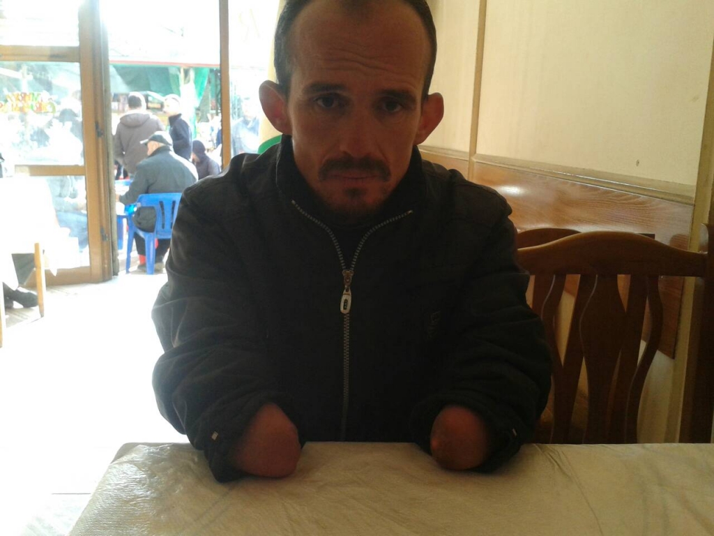 Skandali. Vjedhin Njeriun Pa Duar. Policia Liron Hajdutin.