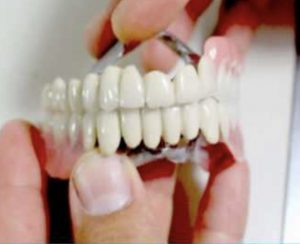 Dyfishimi i çmimeve dentare, PD nxjerr dokumentin me votën e Ministrisë: Pafytyrësi