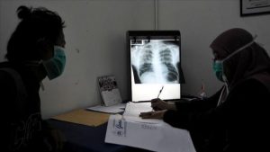 OBSH: 4500 të vdekur çdo ditë nga tuberkulozi