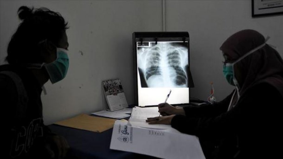 OBSH: 4500 të vdekur çdo ditë nga tuberkulozi