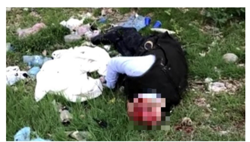 Policia  pranon se ka qëlluar Muratajn por  gëzhoja dhe plumbi  mungojnë