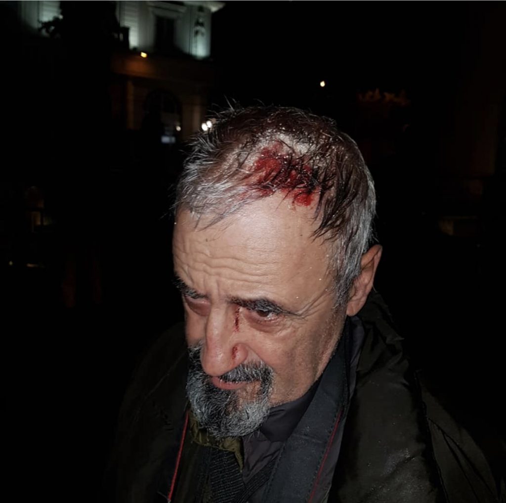 FOTO/Goditet fotoreporteri nga policia