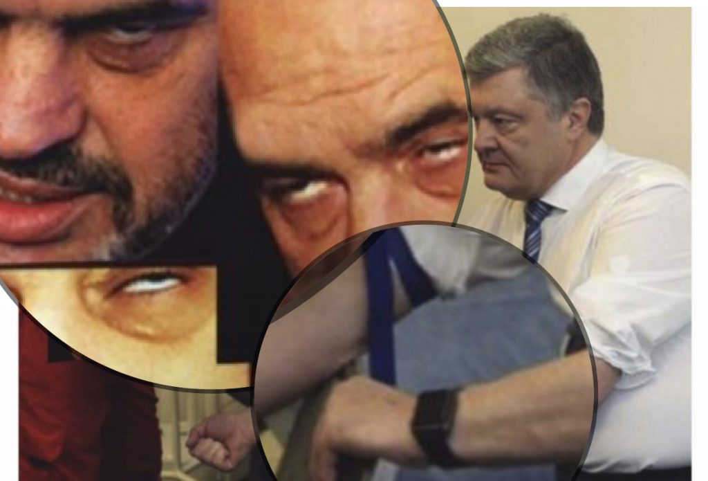 Rama refuzon të bëjë testin e drogës, Berisha thirrje qytetarëve ‘Ta shporrim narkomanin’