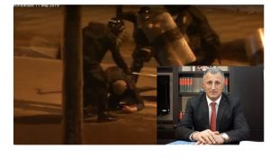 U dhunua nga policia/ Sahit Dollapi probleme serioze, flasin mjekët