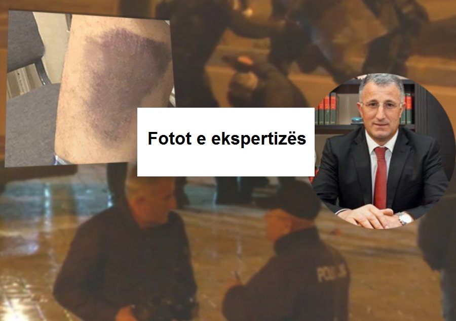 FOTOT e dhunës  policore  ndaj Sahit Dollapit