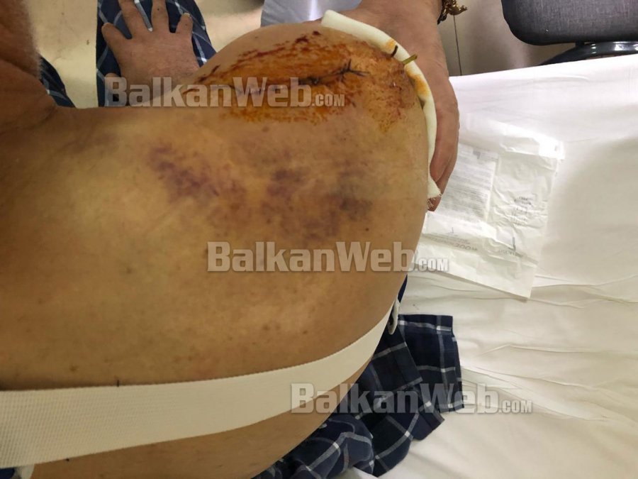 “Shumë krenar që ka ardhur dita që sot bëhet legjendë Sahit Dollapi”-Rama: Ishin vetëm tre goditje dhe ne i cilësuam…