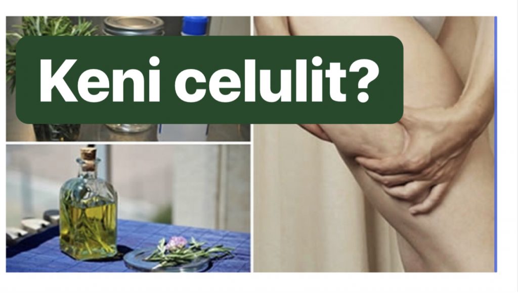 Alkool rozmarine, aleati më i mirë për të eliminuar përgjithmonë celulitin
