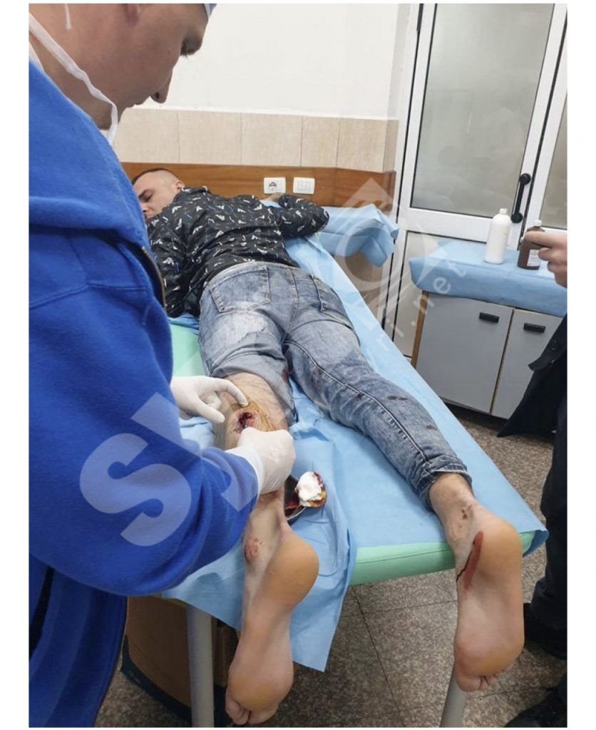 FOTO prova/ Ja i riu i plagosur me armë nga policia