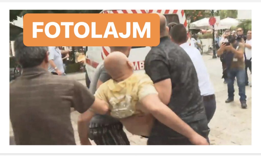 FOTOLAJM/ Protestuesi humb ndjenjat nga gazi lotsjellës, dërgohet në spital me urgjencë