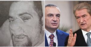 Botuesi Lesi: As Berishën nuk e ka sulmuar kaq poshtërsisht sa Metën  kur e rrahën me leva kokës …