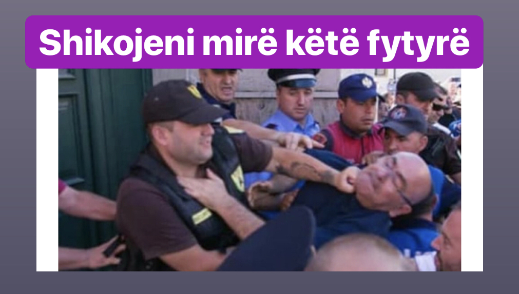 FOTO/Ky është surrati i policisë së Ramës