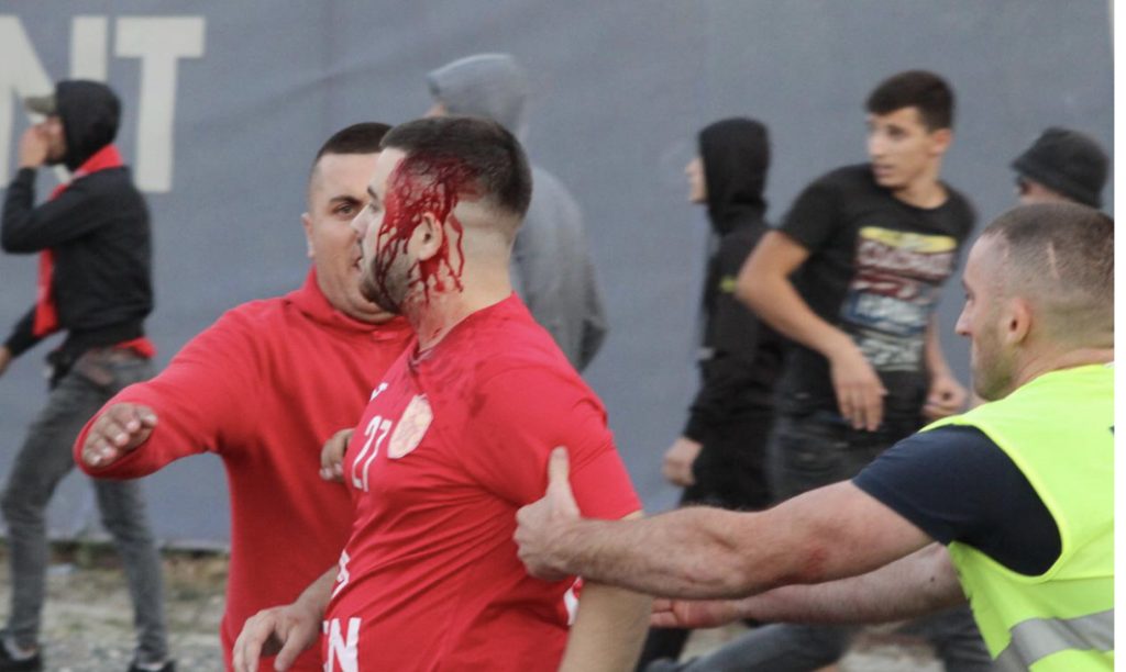 Një i arrestuar dhe 6 persona hetim në gjendje të lirë, dy në kërkim
