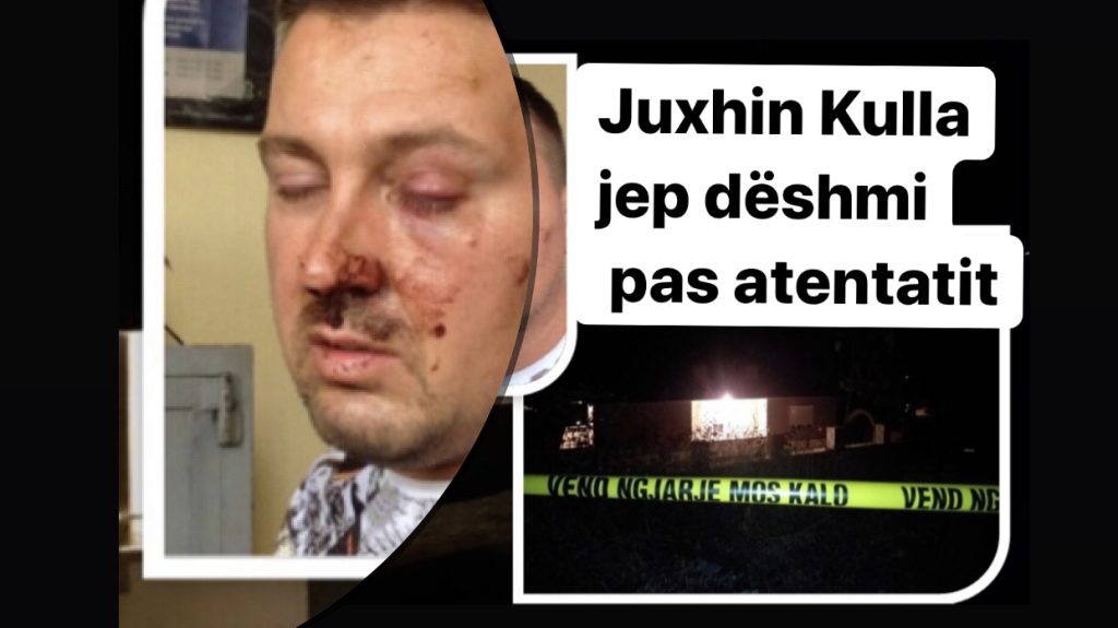 E qëlluan me  breshëri   kallashnikovi: Kam konflikt vetëm me…