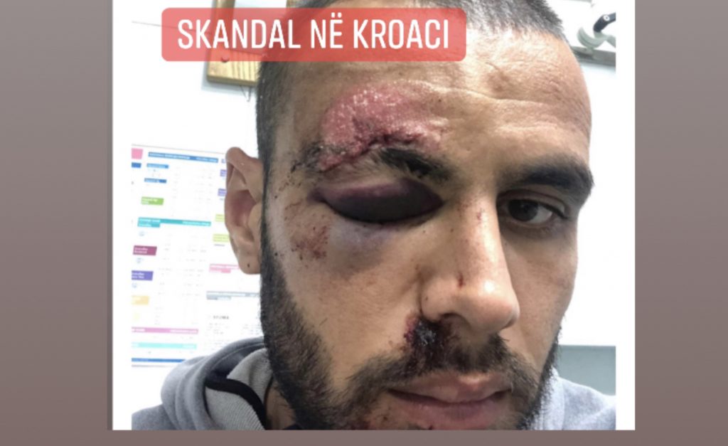 Dhunohet barbarisht sulmuesi shqiptar