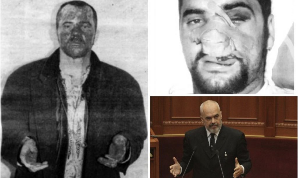 Kumi rrefen per foron e Edi Ramës në ’97: Më erdhi në shtëpi i gjakosur dhe kërkoi…