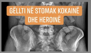 Arrestohet në spital  kishte gëlltitur  560 gramë drogë