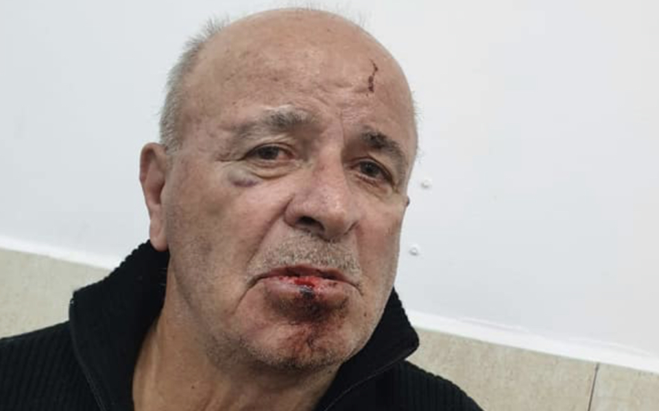 FOTO/ Avokati publikon fotot e 80 vjeçarit: Ka fraktura dhe mpsikje gjaku në kokë