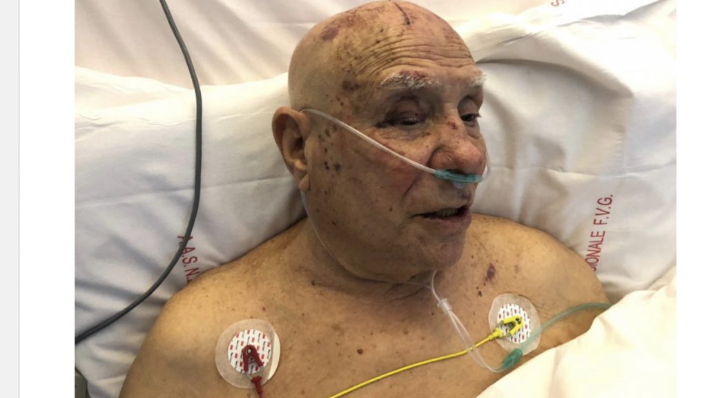 Shqiptarët vjedhin dhe rrahin brutalisht italianin