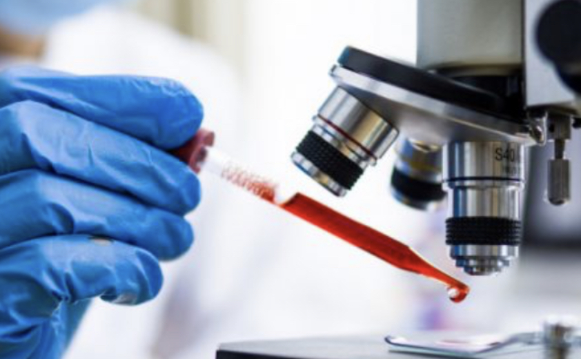 Dalin rezultatet e analizave për 17 mjekët e dyshuar me koronavirus në Fier