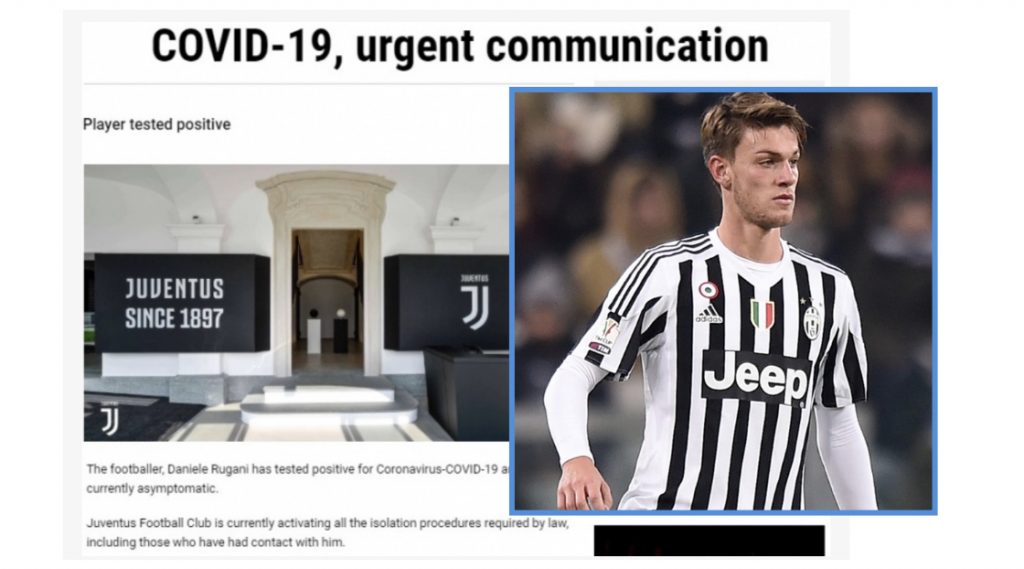 Lojtari i Juventus teston pozitiv me koronavirus