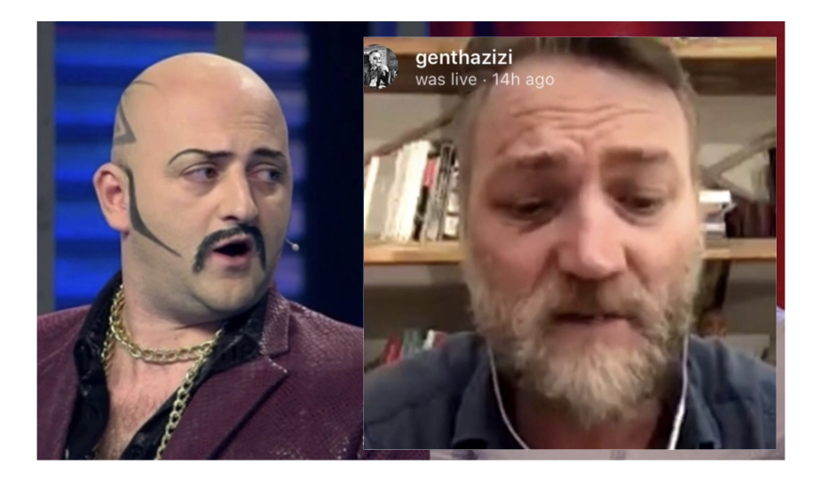 Pas sherrit me grushte me Kapo Kapllanin, Gent Hazizi shfaqet në publik me syrin e nxirë