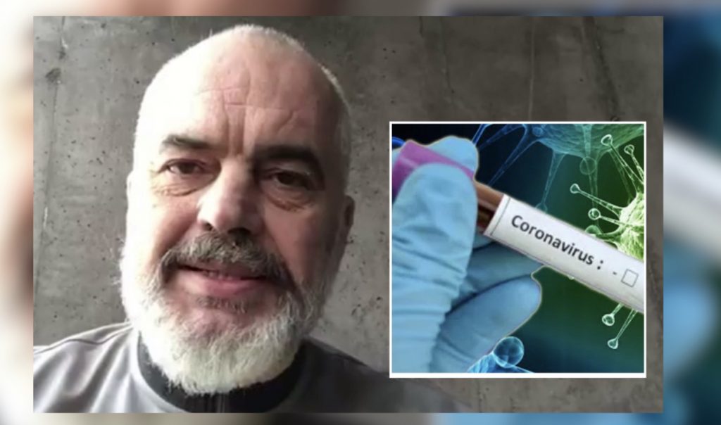 Rama dhe të gjithë ministrat kanë bërë tamponin në një spital privat