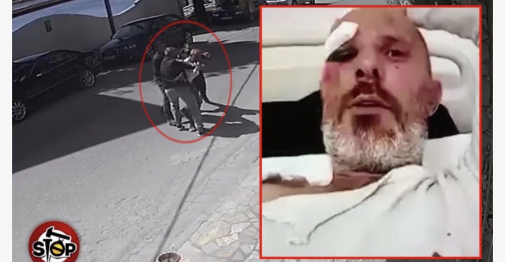 Biznesmeni merr djalin dhe nipin dhe rrahin barbarisht qytetarin në mes të rrugës