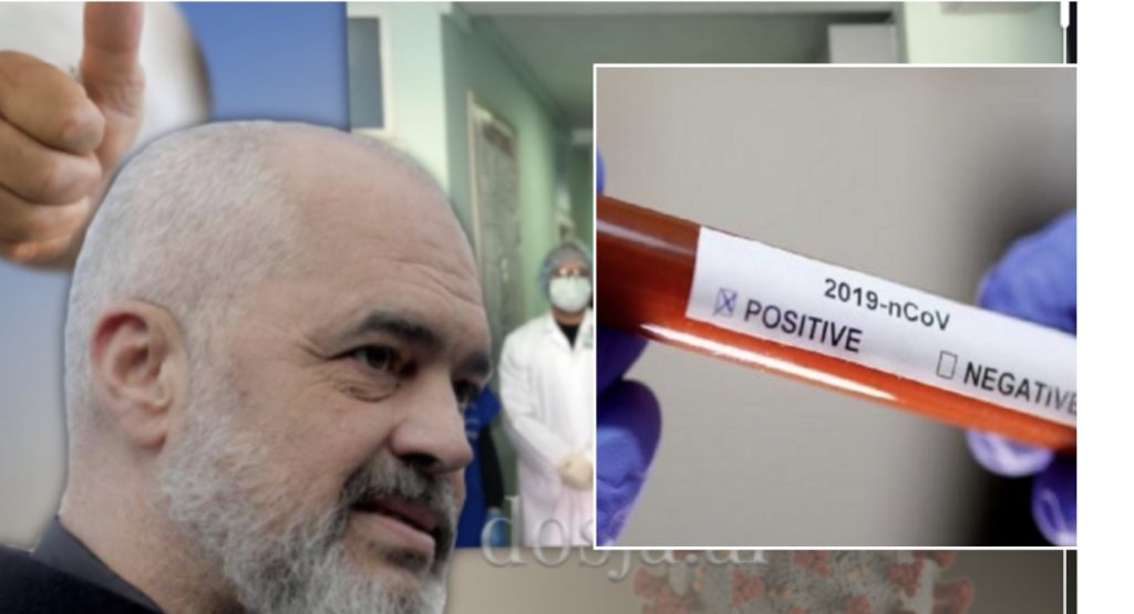 Testimet në masë, Rama: PD ia fut kot. PIKË!