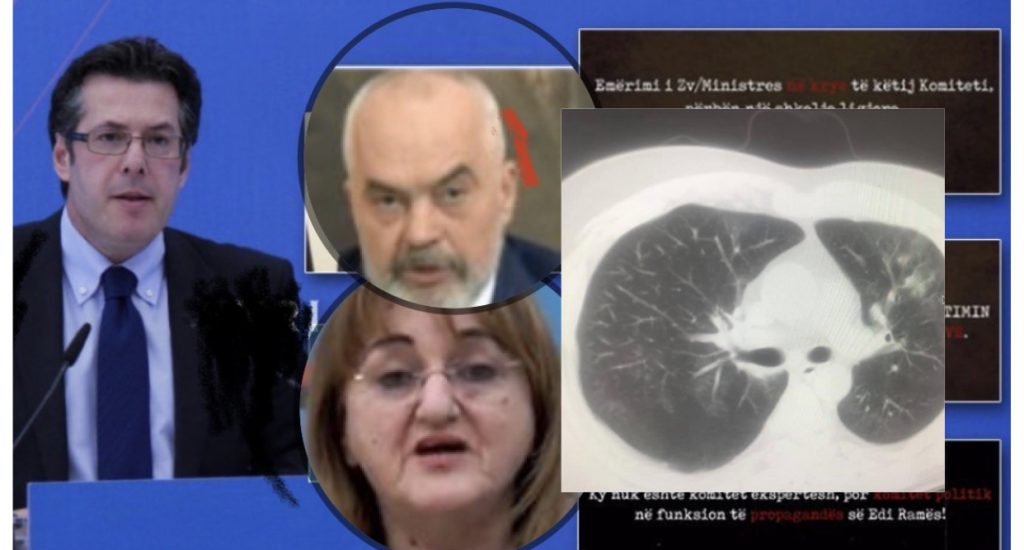 Mjeku publikon grafitë: Virusi që me 31 dhjetor?