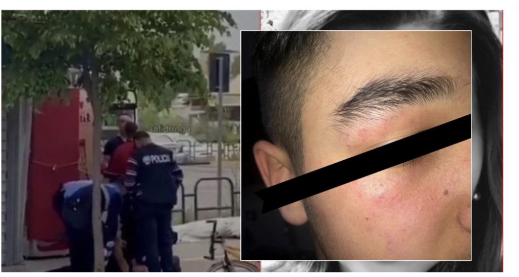 5 shtazët e Lleshajt  me fytyrë njeriu