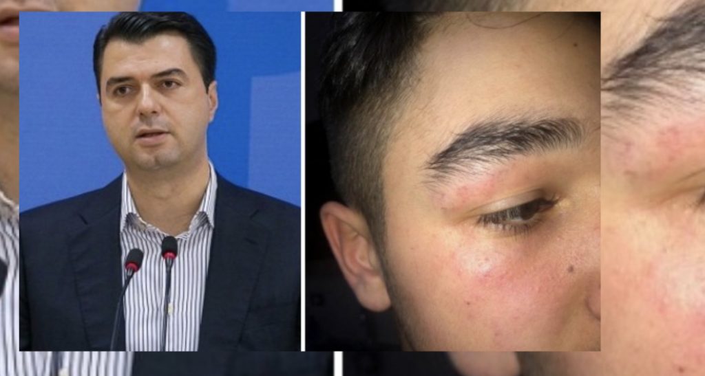 Dhunimi i 15-vjeçarit nga policia, reagon Basha: Kjo është fytyra e shtetit të Ramës