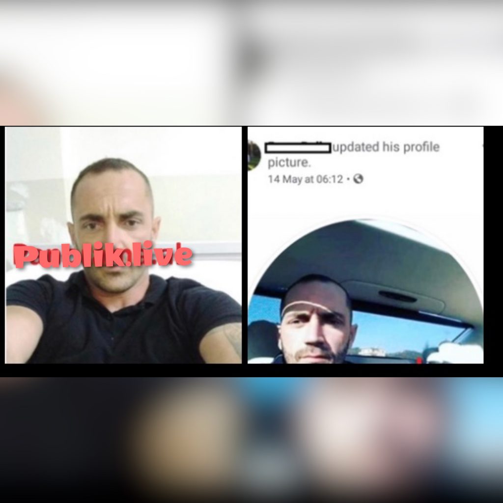31-vjeçari  që u plagos në Peqin, poston ‘selfie’ në rrjetet sociale nga spitali
