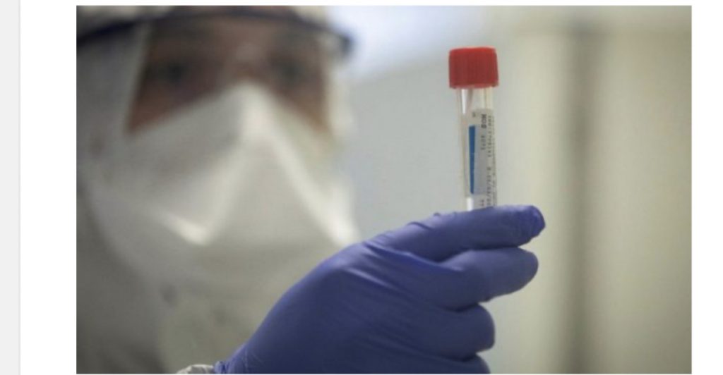 Raste të reja me koronavirus edhe në Mat