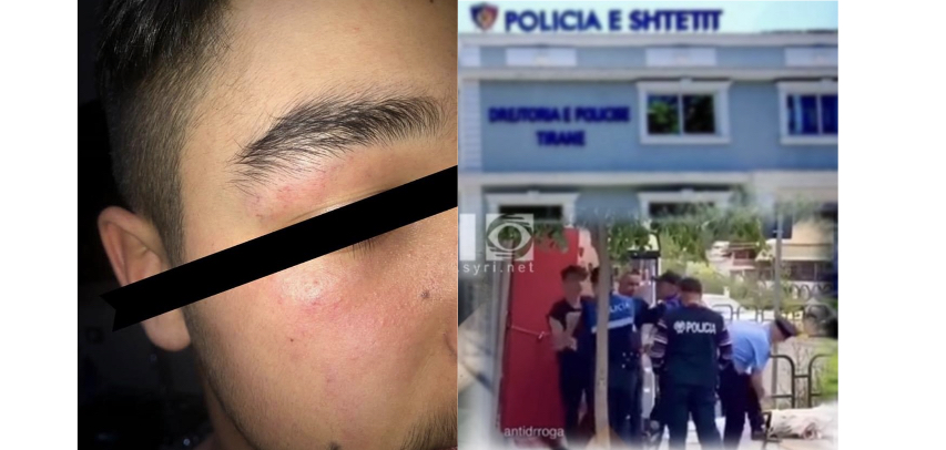 Skandali/ Nuk ka ndjekje penale për policët dhunues