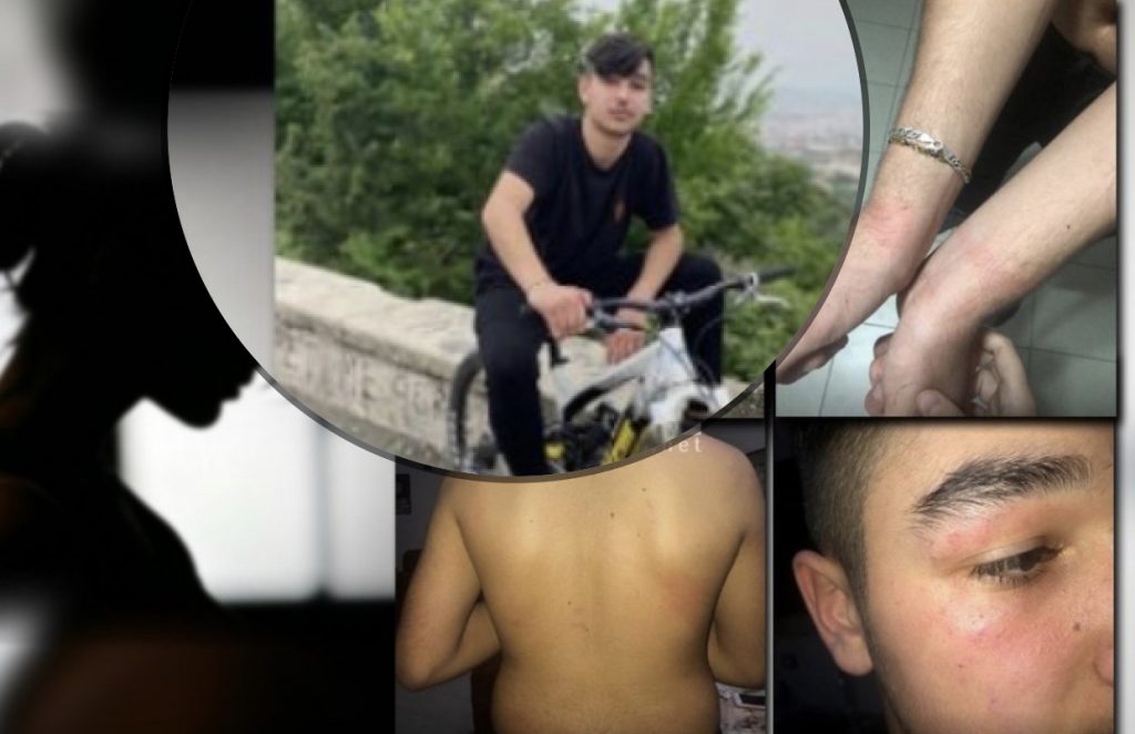 Dëshmia tronditëse e nënës së adoleshentit të dhunuar: Nuk shkoja dot në spital