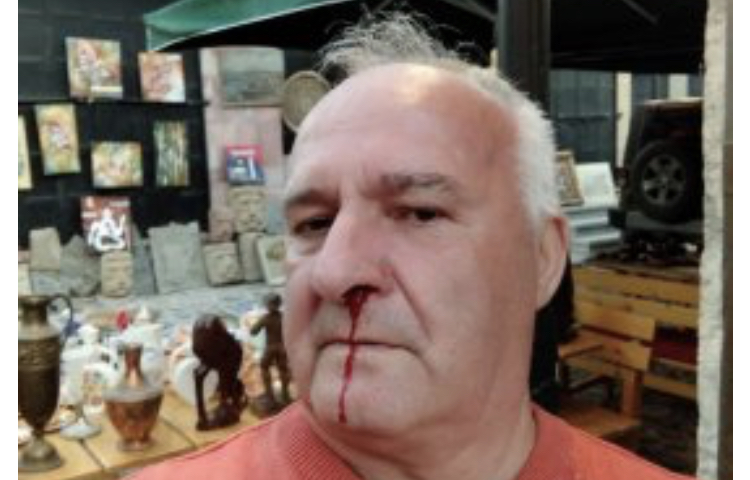 Rilindja përgjak Gjergji Thimion/ Kunati i Niko Peleshit rreh barbarisht koleksionistin nga Korça!