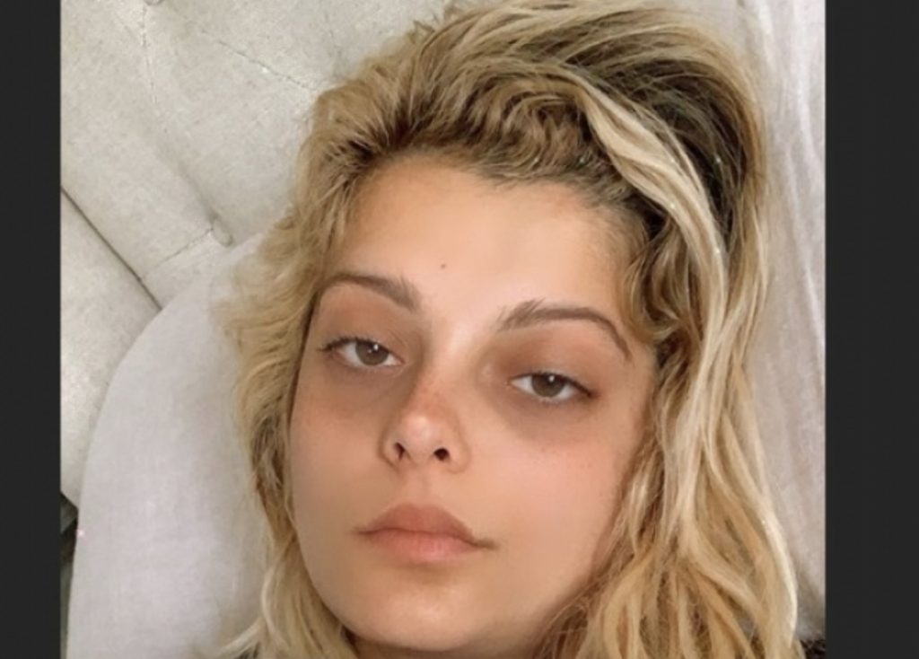 Bebe Rexha jep lajmin e trishtë: Do t’i nënshtrohem operacionit