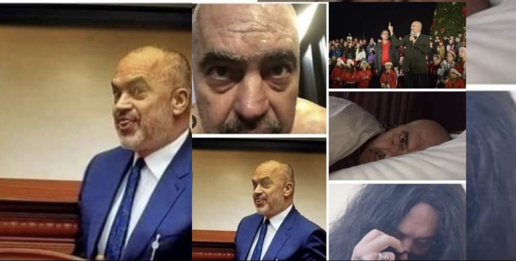 Shenja e pabarazisë mes Bashës dhe Ramës