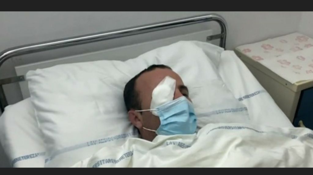 Polici i dëmtuar në njërin sy në protestën e djeshme dërgohet në Turqi