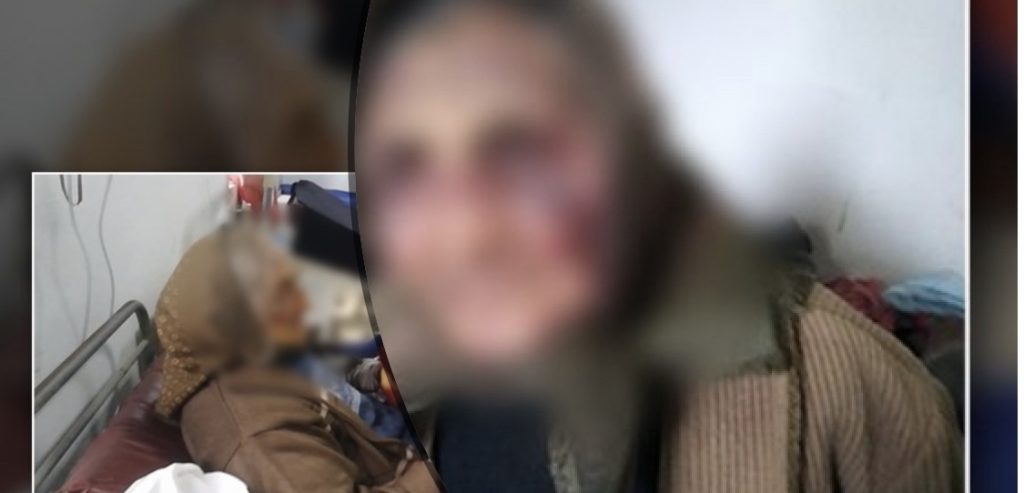E moshuara që u dhunua dhe perdhunua nga nipi: Më bëri e torturoi si deshi vetë