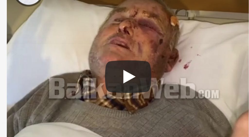 Rrihen barbarisht çifti i të moshuarve në Kavajë, 70-vjeçari: Për një orë na goditën me hunj e grushte
