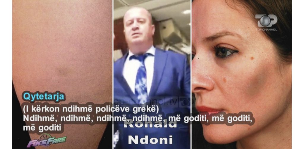“Do t’ju thyej brinjët, legenë, dilni jashtë!”- Punonjësi i Konsullatës rreh qytetarët
