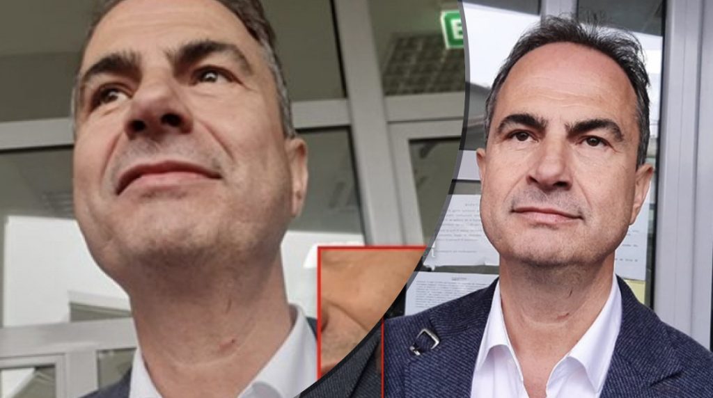 FOTO/ Gjergj Luca sulmon fizikisht kandidatin e PD, Boçi: Banditi i Ramës, agresion politik