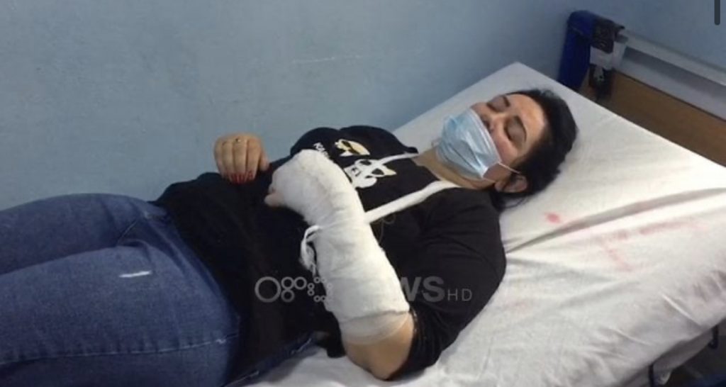Më krahun e thyer, qytetarja denoncon për dhunë shefin e komisariatit në Divjakë: Më tha pse po filmon dhe…