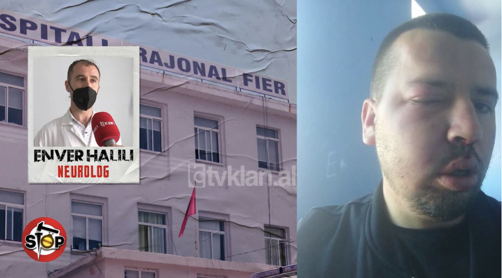 Zbardhet skandali në Spitalin e Fierit. Katër mjekët rrahin barbarisht qytetarin dhe e shajnë me fjalor rruge